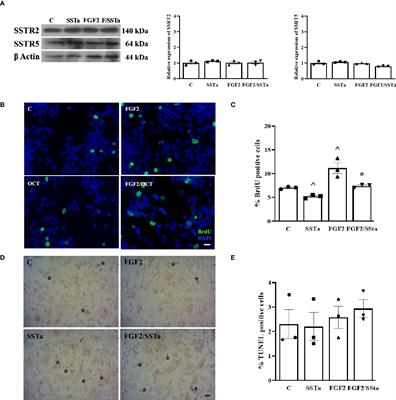 Regulation of FGF2-induced proliferation by inhibitory GPCR in normal pituitary cells